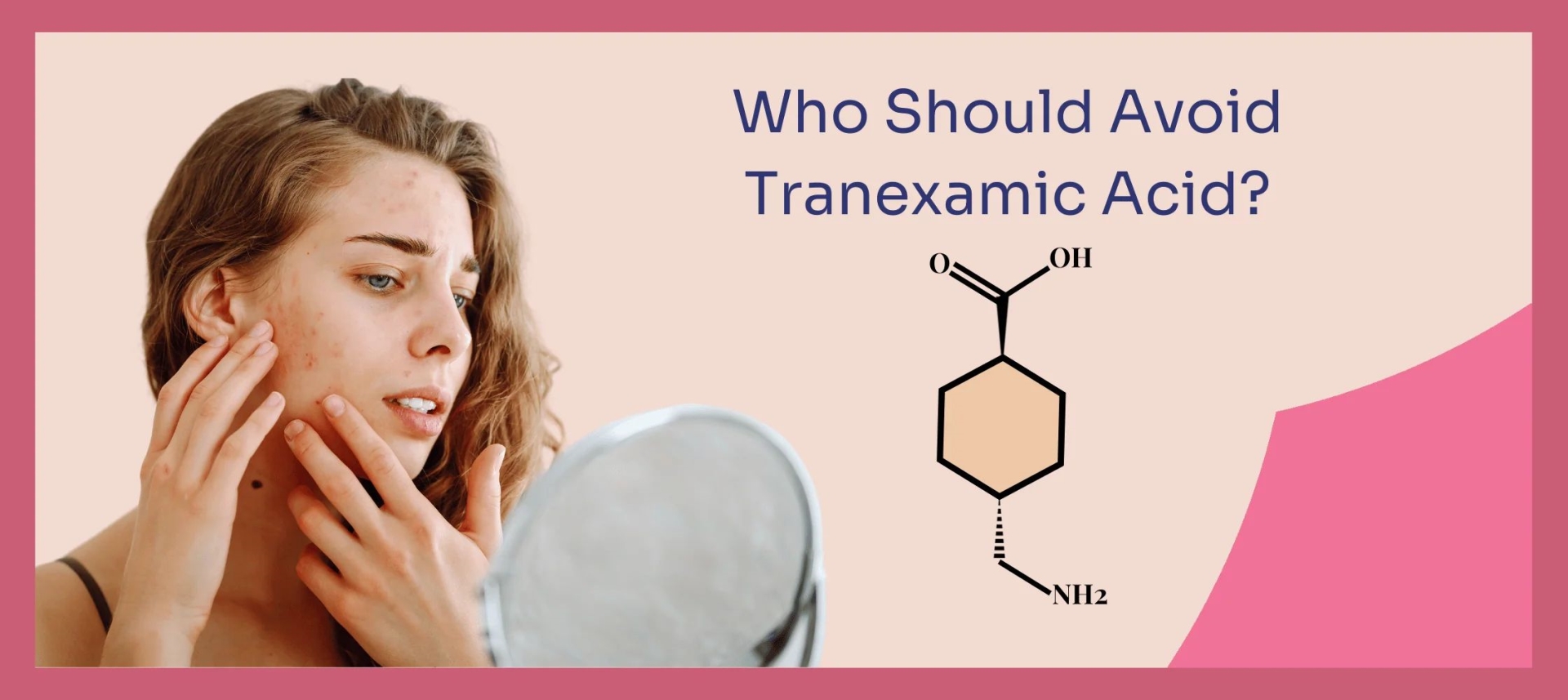 网红“氨甲环酸”被批准用于色斑治疗了吗？